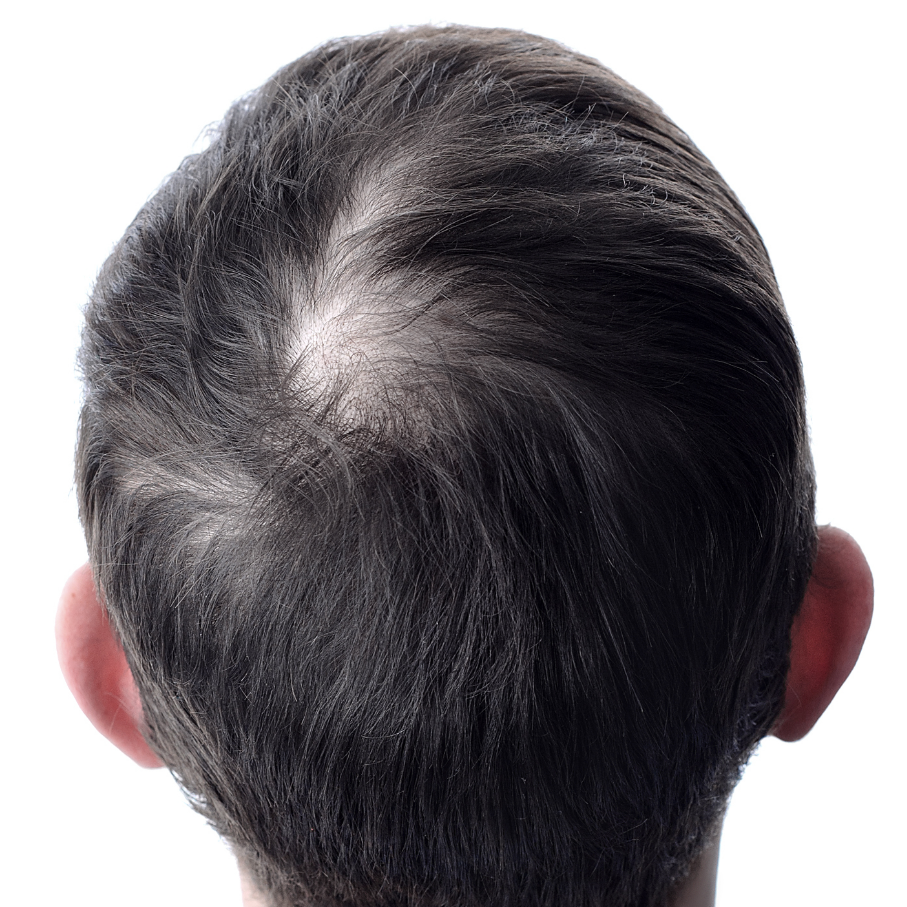 Poudre cheveux : comment camoufler les zones clairsemées instantanément ?